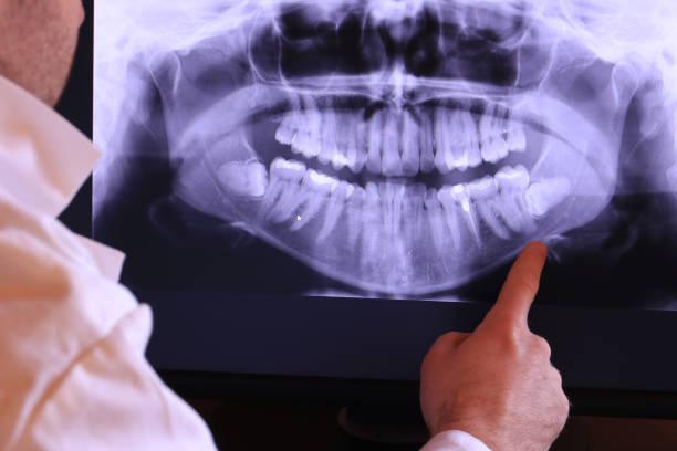 Best Emergency Dental Care for Broken or Chipped Teeth in Woodcrest, CA